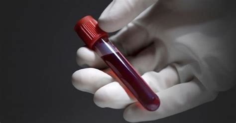 hemogram testi plt nedir